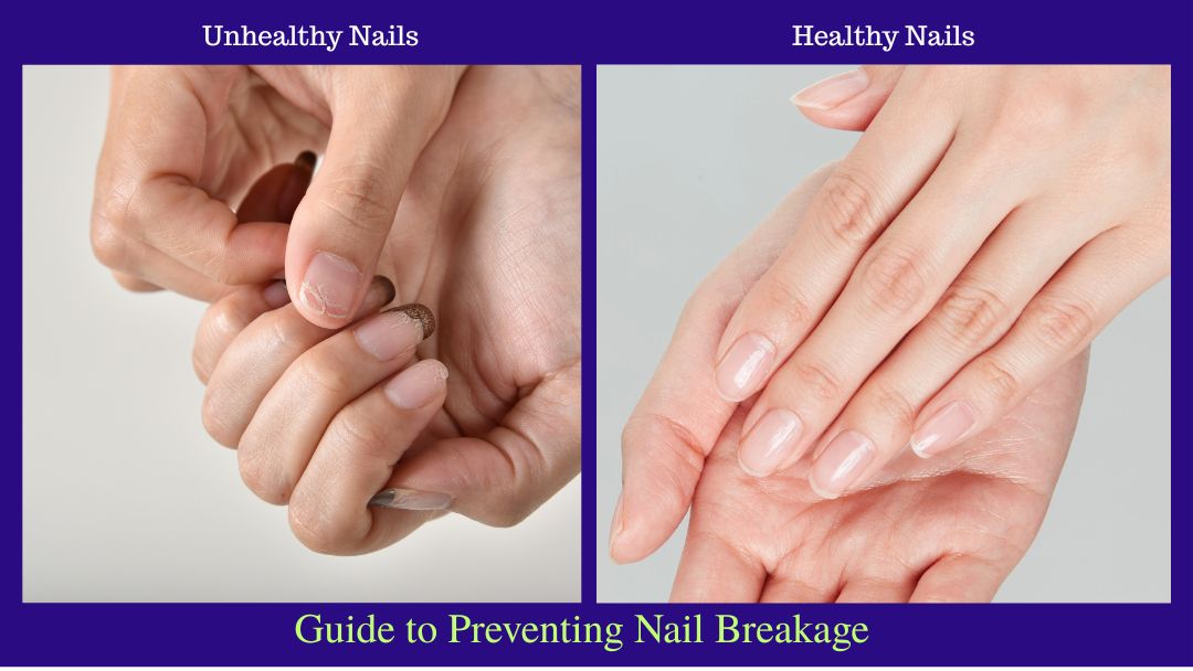 Header with split images;  hand with broken nails and hand beautiful healthy nails</p>
<p>